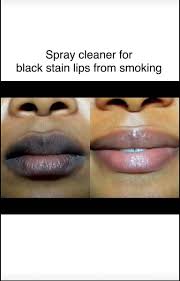 lip lightening balm spray black stain