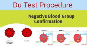 du blood group procedure