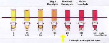 Hemolysis Chart