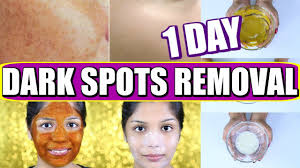 how to remove dark spots on face 1