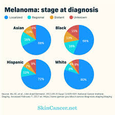 Skin Cancer In People With Dark Skin Tones Skincancer Net