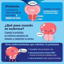 cáncer de próstata síntomas factores