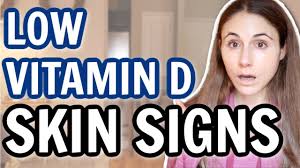 skin signs of low vitamin d drdrayzday