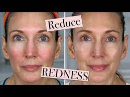 reduce calm redness skincare
