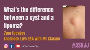 difference between a cyst and a lipoma