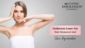 underarm laser for hair removal and