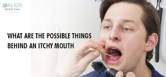 possible causes of itchy mouth