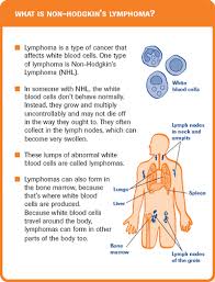 What Is Non Hodgkin Lymphoma Fighting Non Hodgkin For Now A