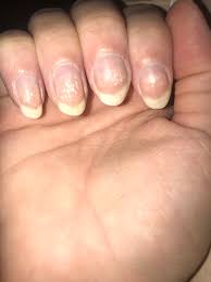 white spots on nails should i be
