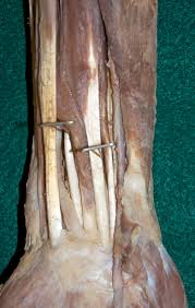 Forearm tendonitis is aggravation of the tendons of the lower arm. Upper Extremities