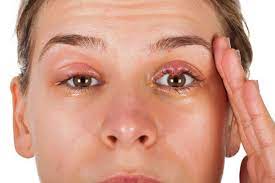 eyelid swollen symptoms causes