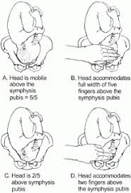 How To Encourage The Baby To Engage In The Pelvis Thereby