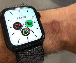 apple watch sensor from burning your wrist
