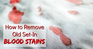 how to remove dried set in blood stains
