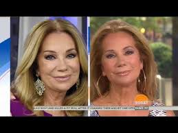 kathie lee s ultherapy sesh on the