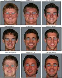 I decided to make a scale of my interpretation of the scale. Objective Assessment Of The Contribution Of Dental Esthetics And Facial Attractiveness In Men Via Eye Tracking Sciencedirect
