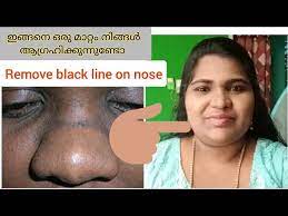 remove black line on nose black line