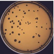 reading diffe types of agar plates