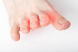 5 causes of chronic toe pain allcare