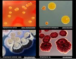 Colony Morphology Of Various Bacteria Laboratoryinfo Com