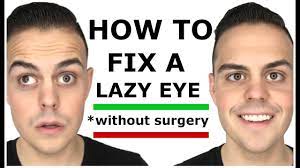 I am going to go over with you 2 exercises that you guys need to do if you want. How To Fix A Lazy Eye With One Crazy Trick Youtube