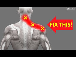 pinched nerve pain in the neck