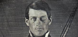 Case Studies and Observational Research Slides Prepared by Alison     Study com Phineas Gage s brain