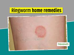 prevent ringworm