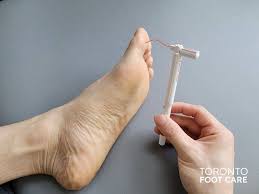 diabetic foot care toronto foot care