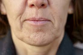 crepey skin treatments help reduce
