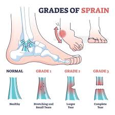 foot ankle pain treatment singapore