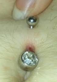 navel piercing problem with photos
