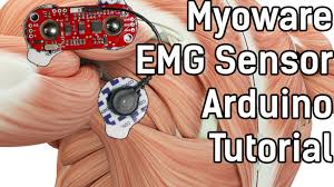 Myoware Emg Sensor Arduino Tutorial Cost Effective Emg
