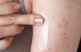 Dermatite atopica negli adulti: sintomi e rimedi - Cure-Naturali.it