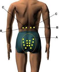 Acupressure Points For Relieving Impotency Sexual Problems