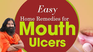 easy home remes for mouth ulcers