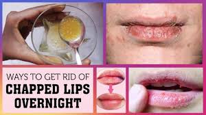 cure dry chapped lips overnight 100