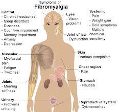 Chiropractic And Fibromyalgia Dr Becky Laird D C