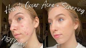 how to apply makeup on acne scarring