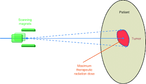 pencil beam scanning delivery