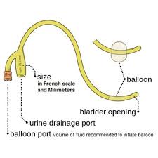 Bard Bardex Lubricath Two Way Tiemann Model Red Foley Catheter With 5cc Balloon Capacity