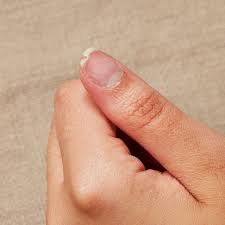 how to fix a broken nail according to