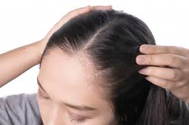 When it comes to the hair game, asian women have the advantage of being born with beautiful silky black strands. Premium Photo Young Asian Women Worry About Problem Hair Loss Head Bald Dandruff