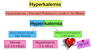 hyperkalemia ecg changes findings and