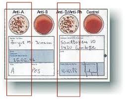 blood type test determine blood type
