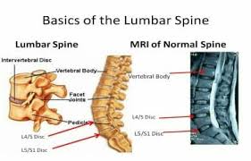 homeopathic management of spinal disorders