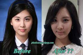 who has no plastic surgery in snsd