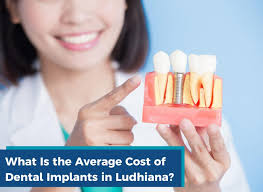 average cost of dental implants in ludhiana