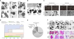 Patient Derived Lung Cancer Organoids