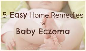 baby eczema home remes